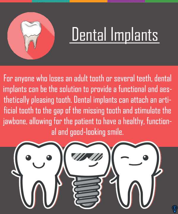 Lost An Adult Tooth? Keep Calm And Get A Dental Implant