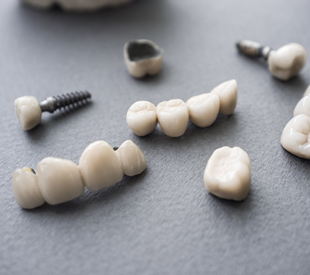 Moreno Valley The Difference Between Dental Implants and Mini Dental Implants