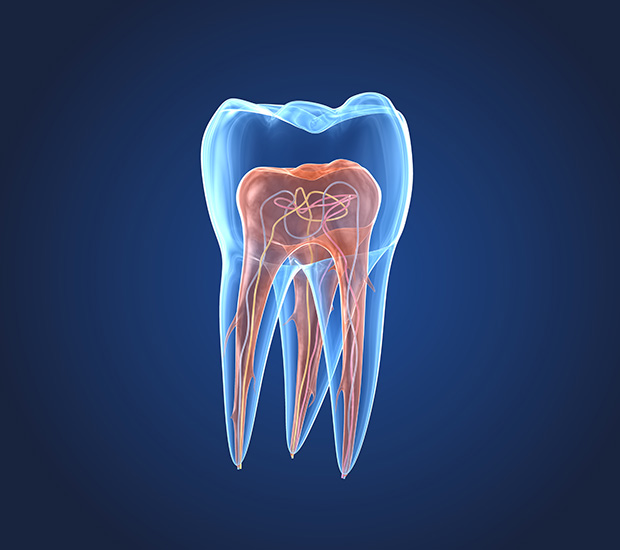 Moreno Valley What is an Endodontist
